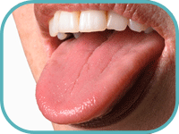 Belegte Zunge Reinigen